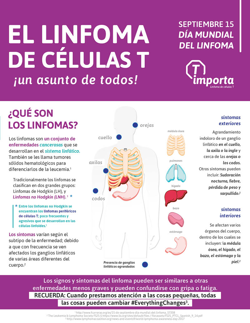 FDA publicó actualización acerca de casos de linfoma T anaplásico de células grandes asociado a implante mamario